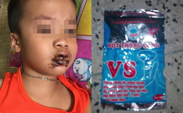 4 trẻ mầm non nhập viện cấp cứu do ăn nhầm bột thông cống